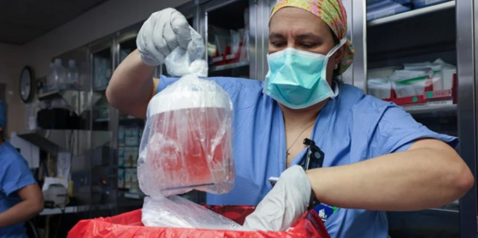 Nuevo hito en medicina: realizan con éxito el primer trasplante de riñón de un cerdo a una persona viva