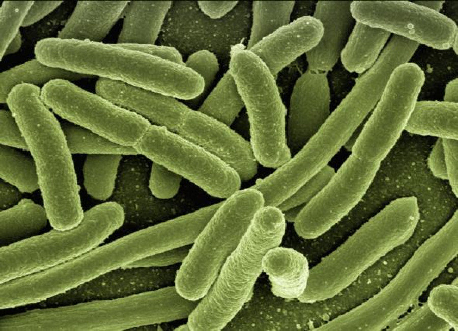 Gerd Altmann   E. coli.preview