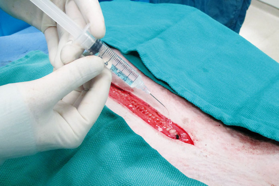 Anestesia