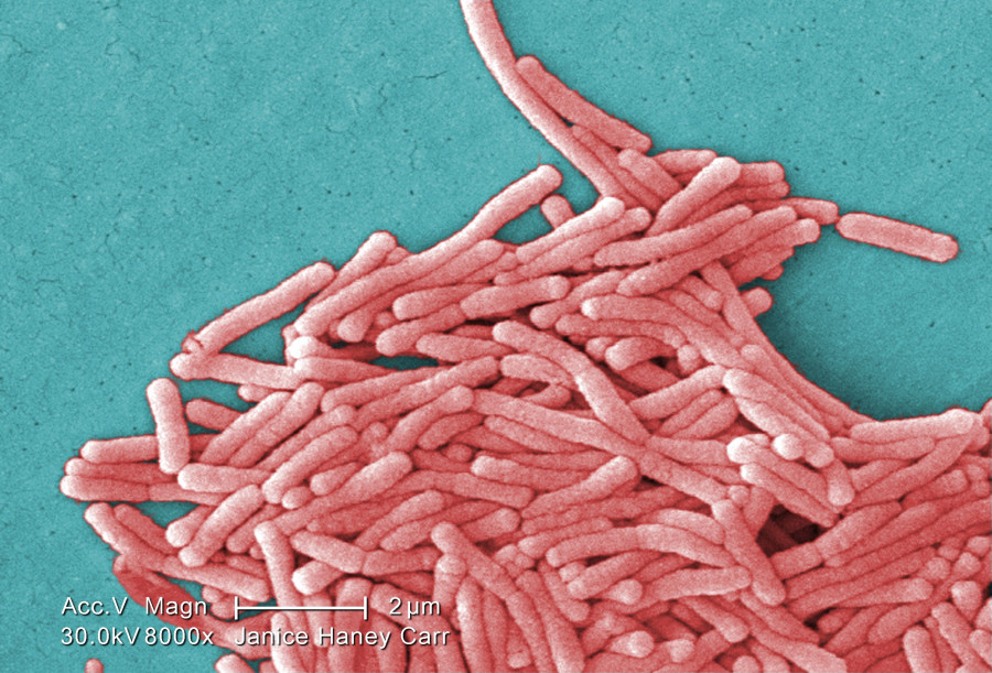 Legionella pneumophila (SEM)