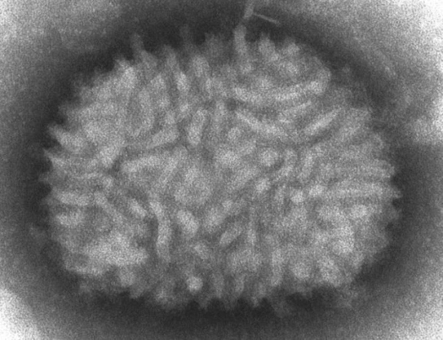 Vaccinia virus cdccynthia goldsmith web