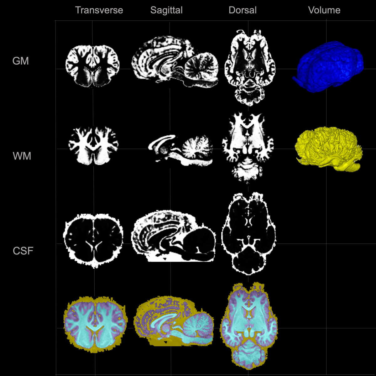 Atlas cerebral equino