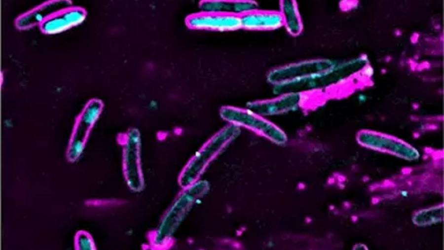 Ecoli
