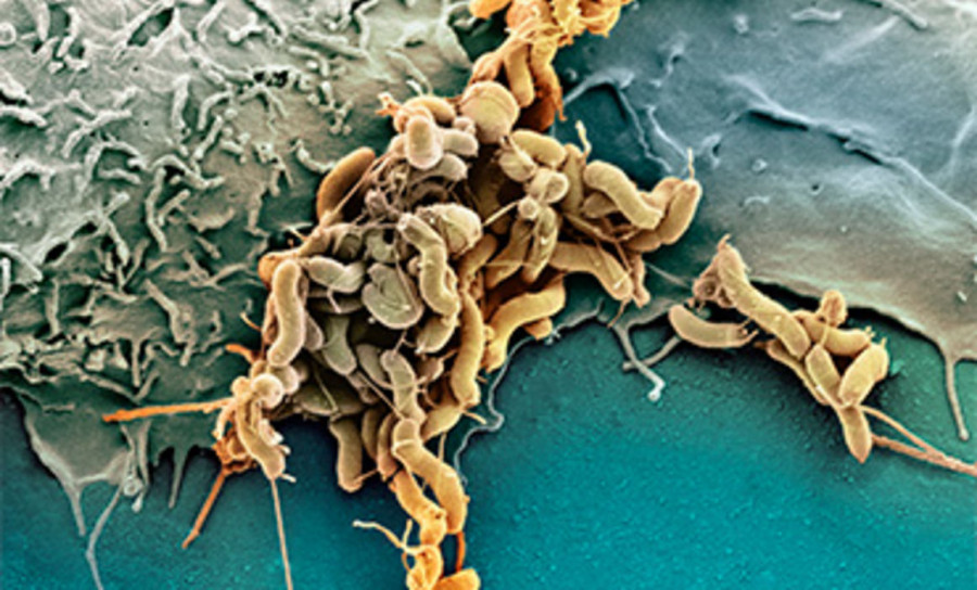 Campylobacteriosis