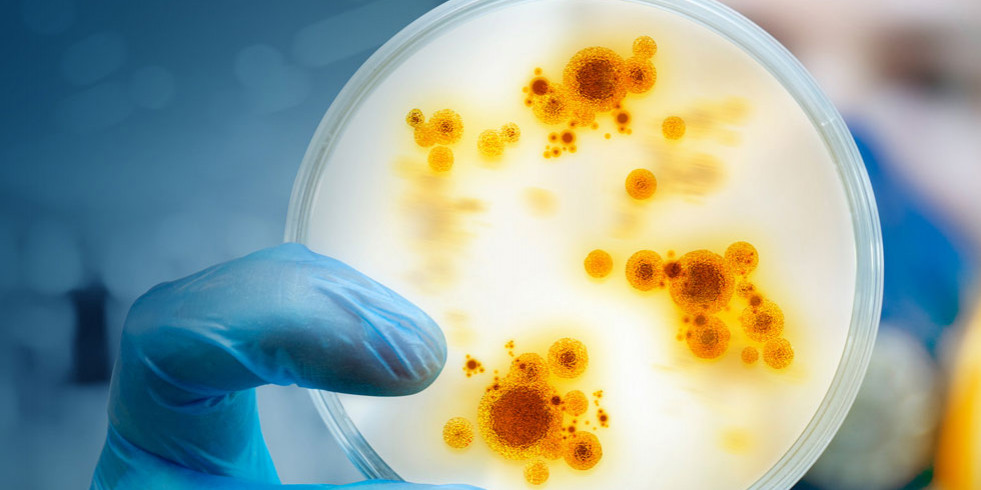 La resistencia a los antibióticos también es un problema alimentario