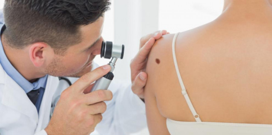 Toglato de tigilanol stelfonta melanoma