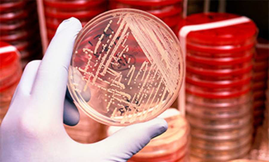 Resistencia antimicrobiana