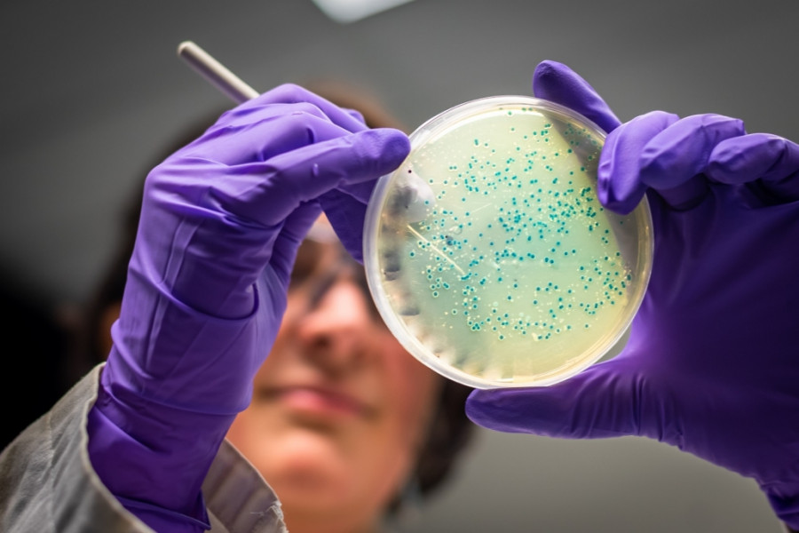 Listeria control alimentos seguridad alimentaria