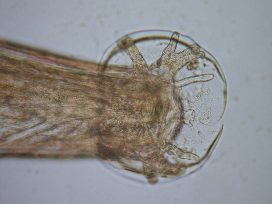 gusano parasitario Angiostrongylus cantonensis