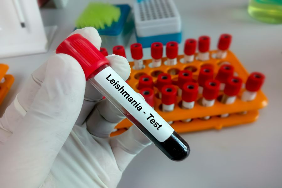 leishmania