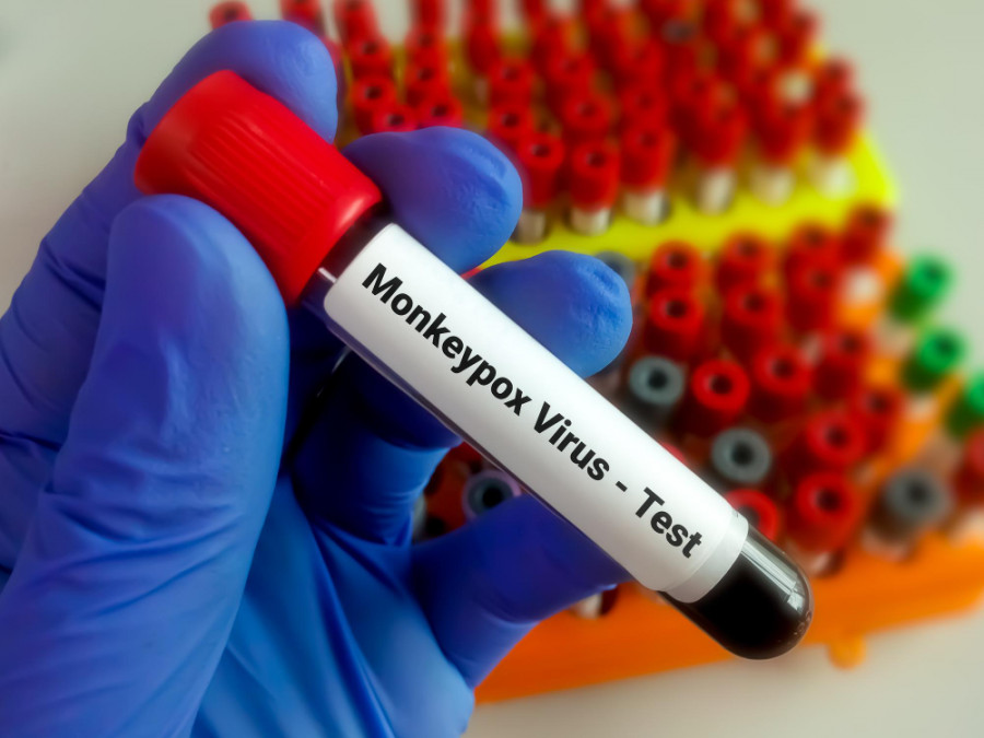 Monkeypox