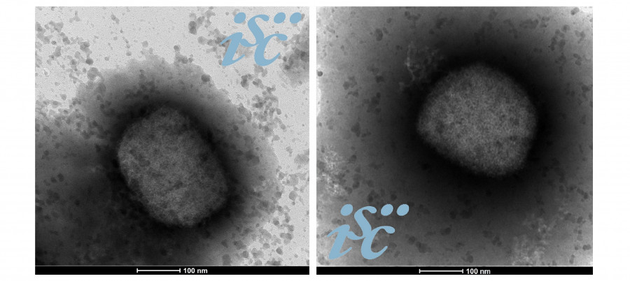 Imagen Monkey Pox microscopía electrónica 6a web