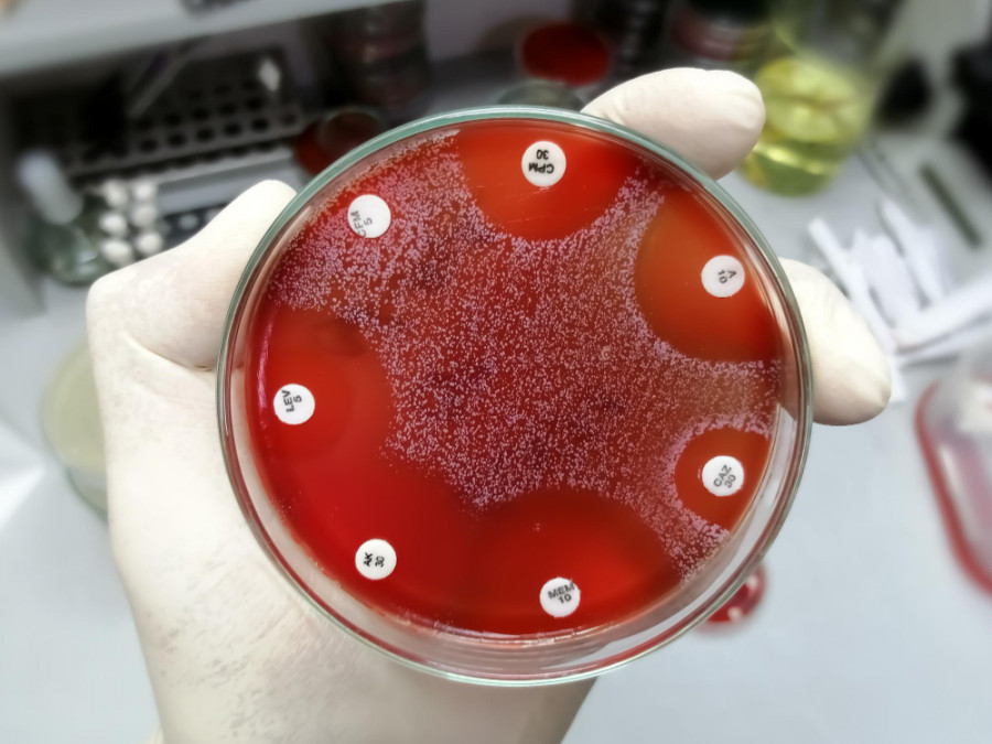 Resistencia antimicrobiana