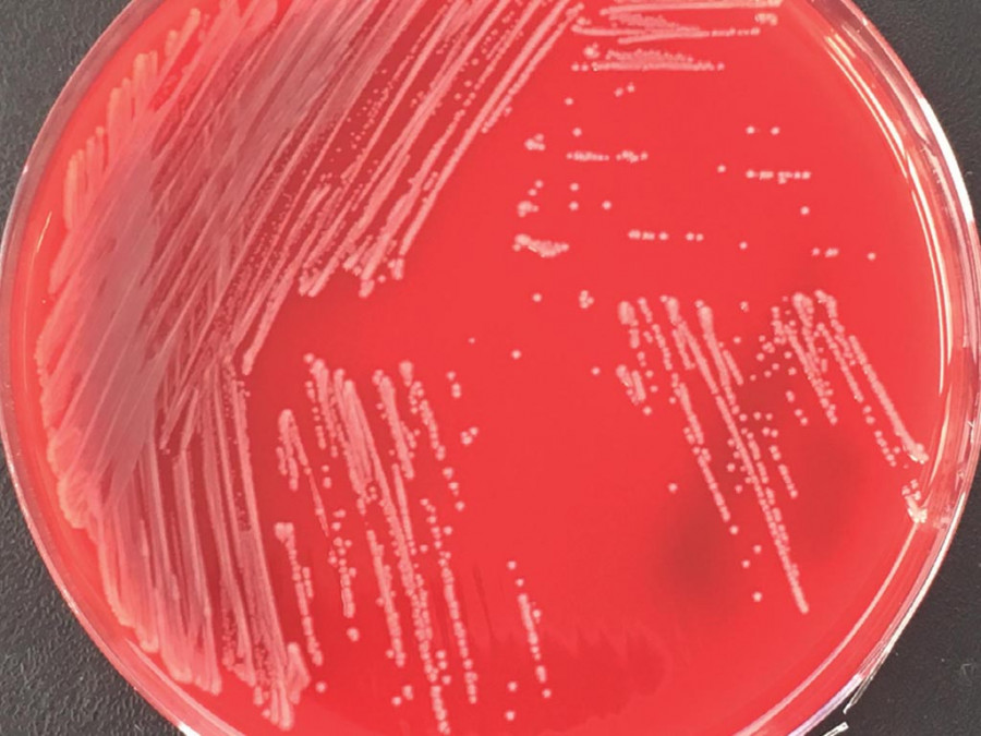 Bacteria resistente