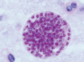 El toxoplasma, un parásito que puede estar detrás de grandes innovaciones y hazañas de la humanidad