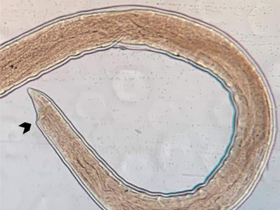 gusano pulmonar de la rata Angiostrongylus cantonensis
