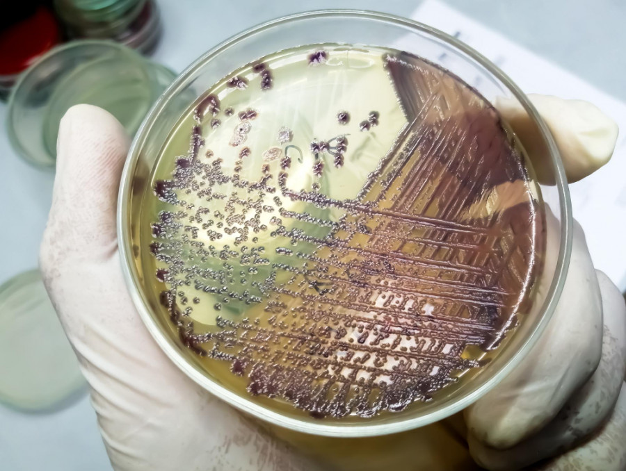 Bacteria