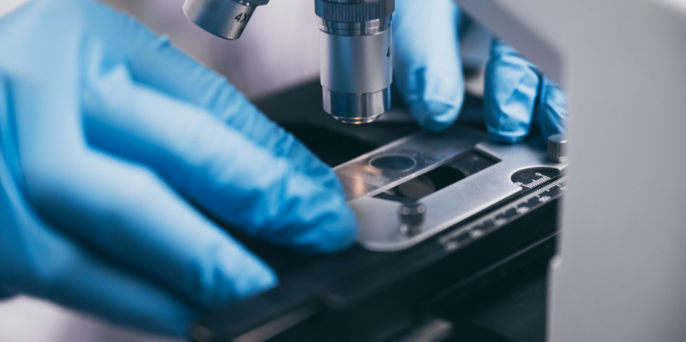 Eficacia y rentabilidad de un nuevo método de detección de parásitos gastrointestinales